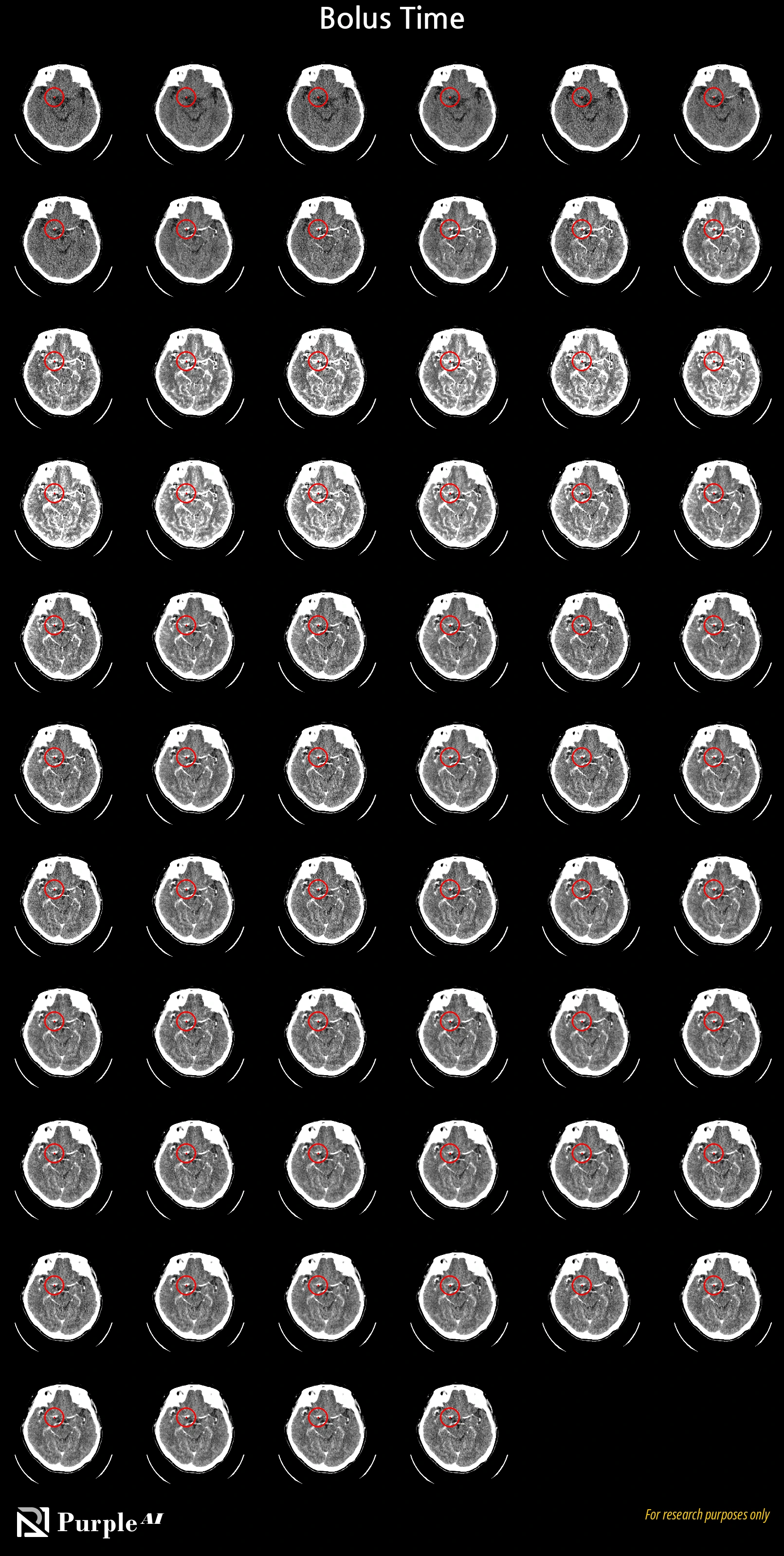 CTP 7